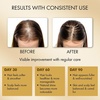 image:imageMajestic Pure Amla Oil 100 Pure amp Natural  4 Fl OzAmla OIl