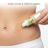 image:imageMajestic Pure USDA Organic Castor Oil 100 Pure amp Natural Body Oil 8 FlOzCastor Oil